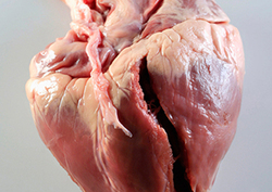 Heart Instructional Video