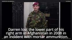 Amputee veteran first to receive 3D-printed bionic ‘hero’ arm on the NHS News Clip