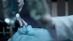 Surgeons operating process. Anesthesiologist give mask before operation Stock Footage