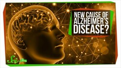 We Might Be Totally Wrong About Alzheimer’s Instructional Video