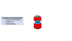 Wernicke’s Encephalopathy | Causes, Symptom Triad & Treatment Instructional Video
