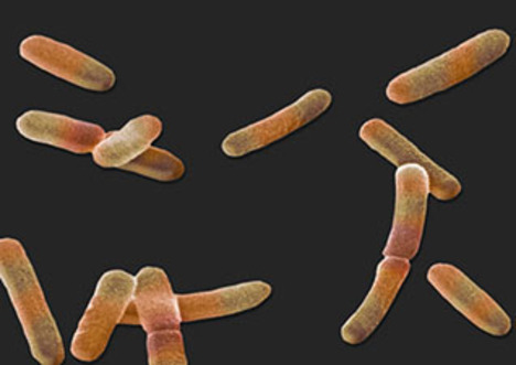 Asexual reproduction