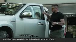 His jaw was blown off. Canadian surgeons helped rebuild it News Clip