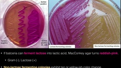 MacConkey Agar Instructional Video