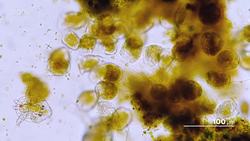 What Are These Vorticella up To Instructional Video