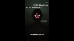 The nightmarish symptoms of fentanyl withdrawal News Clip