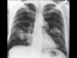 Healthy Circulatory and Respiratory Systems: Problems of the Respiratory System Instructional Video