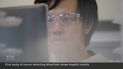 Blood test detects signs of cancer in healthy people, study finds News Clip