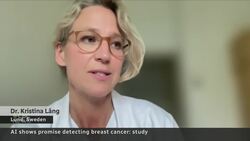 Study suggests AI can help find breast cancer News Clip