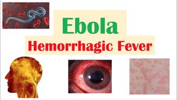 Overview of Ebola Instructional Video