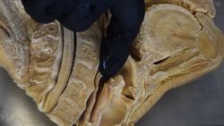 What Happens if You Swallow Gum? Instructional Video