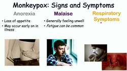 Monkeypox Signs & Symptoms (First Symptom & Stages of Rash) Instructional Video