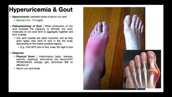 Gout [Part 2] | Gout Pathophysiology, Presentation, & Treatment Instructional Video