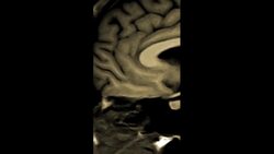 Why Koalas Are The Dumbest Animals On Earth Instructional Video