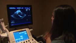 Climbing thyroid cancer rates may reflect overdiagnosis News Clip