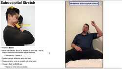 Suboccipital Stretch | Rationale & Technique [General & Unilateral] Instructional Video