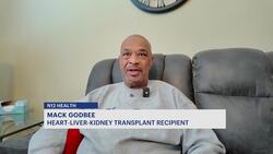 Peekskill man receives 1st heart-liver-kidney transplant in New York News Clip