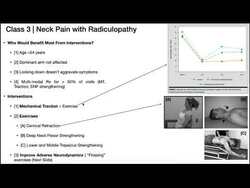 Neck Pain with Cervical Radiculopathy | Presentation + Treatment Instructional Video