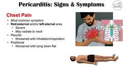Pericarditis (Pericardial Inflammation) Signs & Symptoms (& Why They Occur) Instructional Video