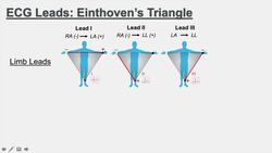 Introduction to ECG | The Basics | Einthoven’s Triangle, Limb, Augmented and Precordial Leads Instructional Video