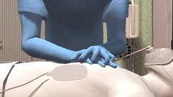 Patient remains awake during 90 minutes of CPR Instructional Video