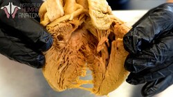 How the Heart Contracts: Understanding the Electrical Activity and Heart Arrhythmias Instructional Video