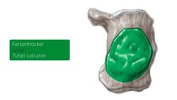 Calcaneus Instructional Video