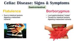 Celiac Disease Signs & Symptoms | Nutrient Deficiencies & Why Symptoms Happen Instructional Video