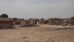 CLEAN : Child malnutrition surges in war-torn Yemen News Clip