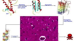 Prions | Mechanism of Classical Creutzfeldt-Jakob Disease (cCJD) Instructional Video