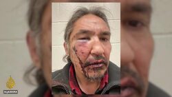 Video of Indigenous chief's arrest 'shocking', says Trudeau News Clip