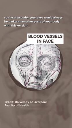 Why do we get dark circles under our eyes? #shorts #science Instructional Video