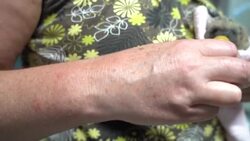 CLEAN : France: Hedgehogs threatened by global warming News Clip