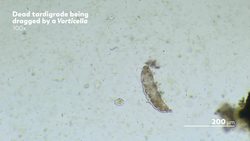 Do Microscopic Immortals Actually Exist Instructional Video