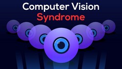 How I CURED my EYE STRAIN (Relief from Computer Vision Syndrome ) Instructional Video