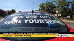 How a message on a car helped find a kidney donor News Clip