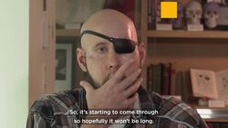 Surgeons successfully perform the world's first transplant of a whole human eye News Clip