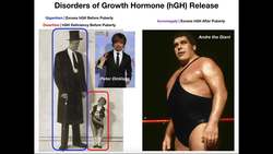 Disorders of Growth Hormone Release [Excess and Deficiency] Instructional Video