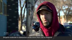 Edmonton health-care workers struggle to control shigella outbreak News Clip