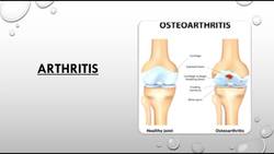 Anatomy and Physiology BTEC SPORT Level 3 UNIT 1- factors affecting the skeletal system Instructional Video