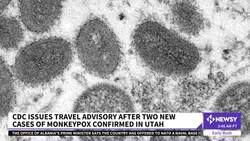 CDC Issues Travel Advisory After 2 New U.S. Monkeypox Cases Confirmed News Clip