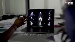 Anxious about mammograms? This device may help you self-check for breast cancer News Clip