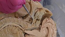 Understanding the Nasopharyngeal Swab Instructional Video