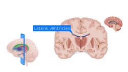 Coronal section of the brain at the level of the thalamus Instructional Video
