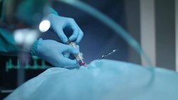Surgeon hands with syringe suction blood. Blood syringe. Surgeon operating Stock Footage