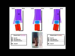 The Subtalar Joint [Part 2] | Pronation vs Supination EXPLAINED Instructional Video