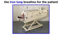 Poliomyelitis (Poliovirus) Instructional Video