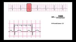 Determine HR from a Regular-Rhythm EKG 1500- & 300-methods Instructional Video