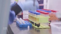 Dose error raises questions about Oxford COVID-19 vaccine News Clip