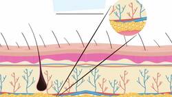 Can A Skin-Colored Tattoo Cover Up A Bad, Older Tattoo? Instructional Video